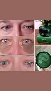 Parche verde para las ojeras